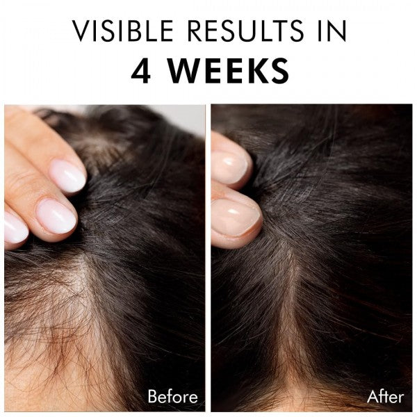 mCaffeine Serum With 20% Caffexil Advanced, Biotin, Keratin & Rosemary | 80% Hair Growth, Increase Density & Control Fall | Nourishes Roots | For Women & Men - 30 Ml,